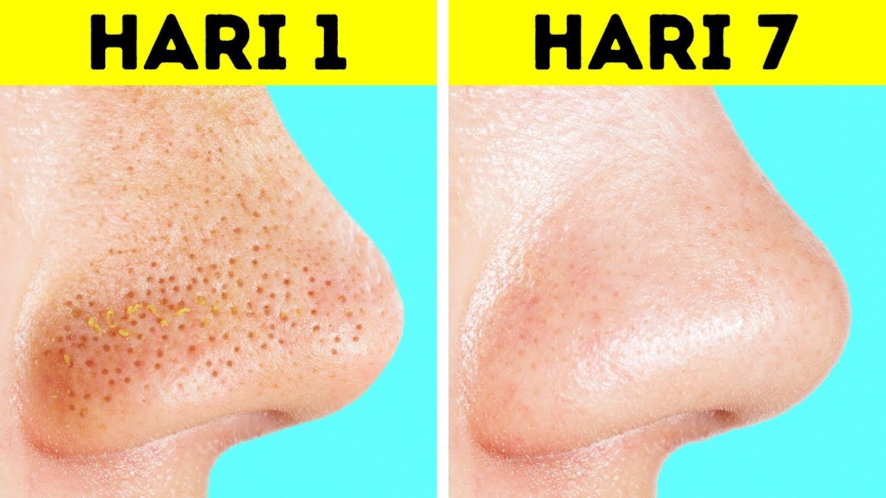 Begini Cara Mengecilkan Pori-Pori Wajah Agar Terlihat Mulus dan Glowing, Cuma 1 Bahan Jadi Putih Bebas Noda