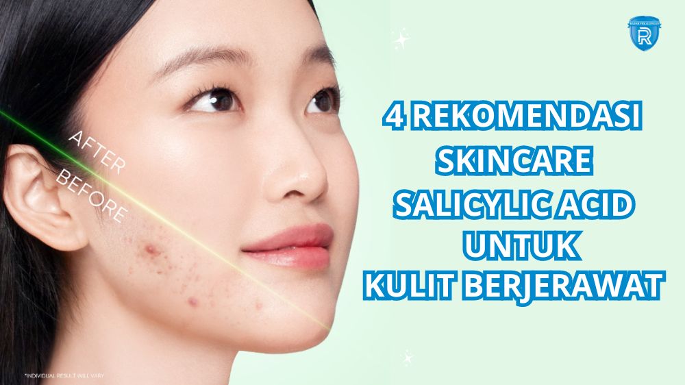 4 Rekomendasi Skincare yang Mengandung Salicylid Acid untuk Mengatasi Jerawat, Yuk Cobain!