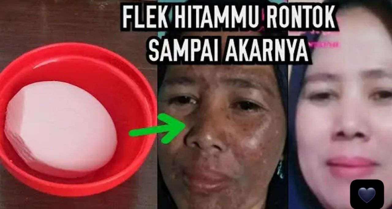 4 Sabun Wajah Batangan Pengelupas Flek Hitam yang Menahun, Ampuh Kecilkan Pori-Pori