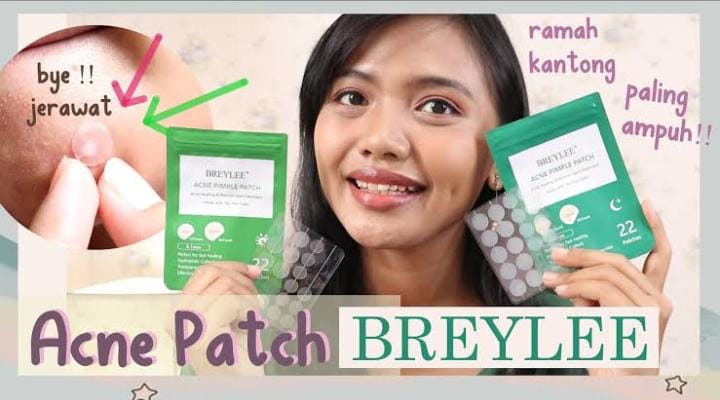 4 Produk Acne Patch Terbaik untuk Menyembuhkan Jerawat dengan Cepat dan Tanpa Bekas, Rahasia Glowing Ala Korea