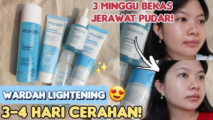 4 Serum Wardah Penghilang Flek Hitam Terbaik, Ampuh Mencerahkan Wajah dan Usir Tanda Penuaan Gak Pakai Lama