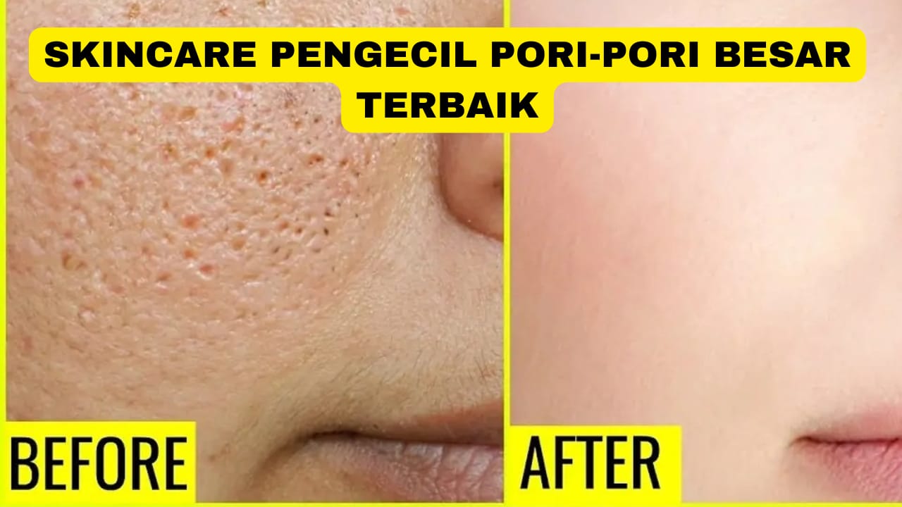 4 Skincare Pengecil Pori-Pori Besar Terbaik, Cocok untuk Usia 40 Tahun an Kulit Langsung Glowing Awet Muda