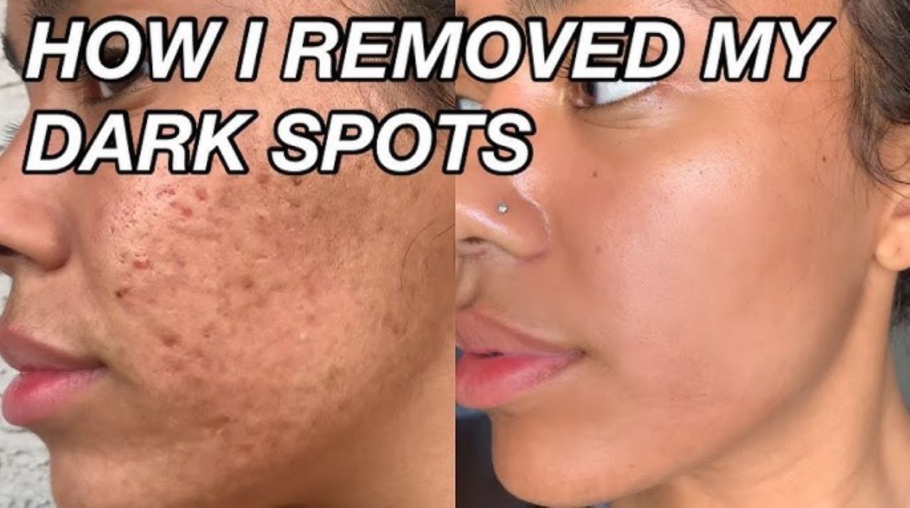 Wajah Glowing Tanpa Flek Hitam! Begini DIY Masker dari 2 Bahan Alami