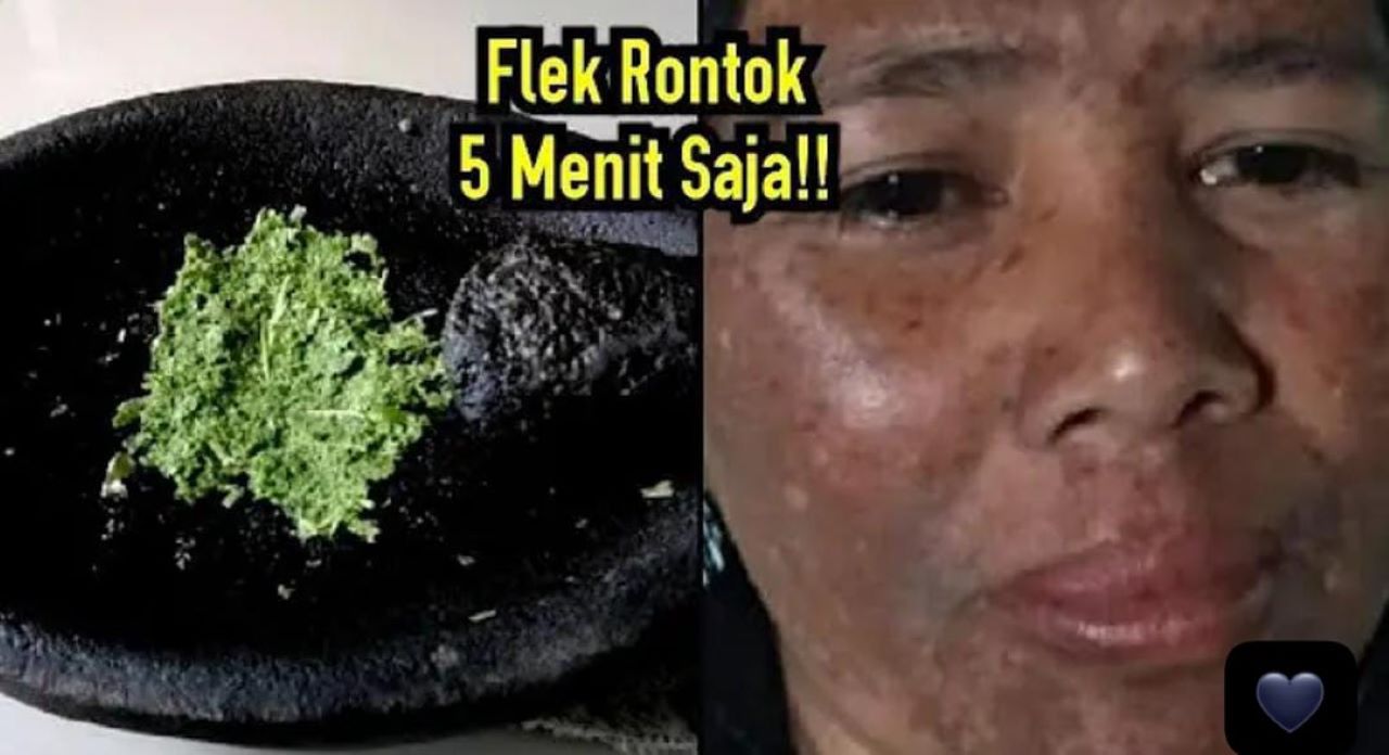 3 Cara Membuat Racikan Masker Buah untuk Menghilangkan Flek Hitam Menahun, Wajah jadi Kinclong dan Cerah