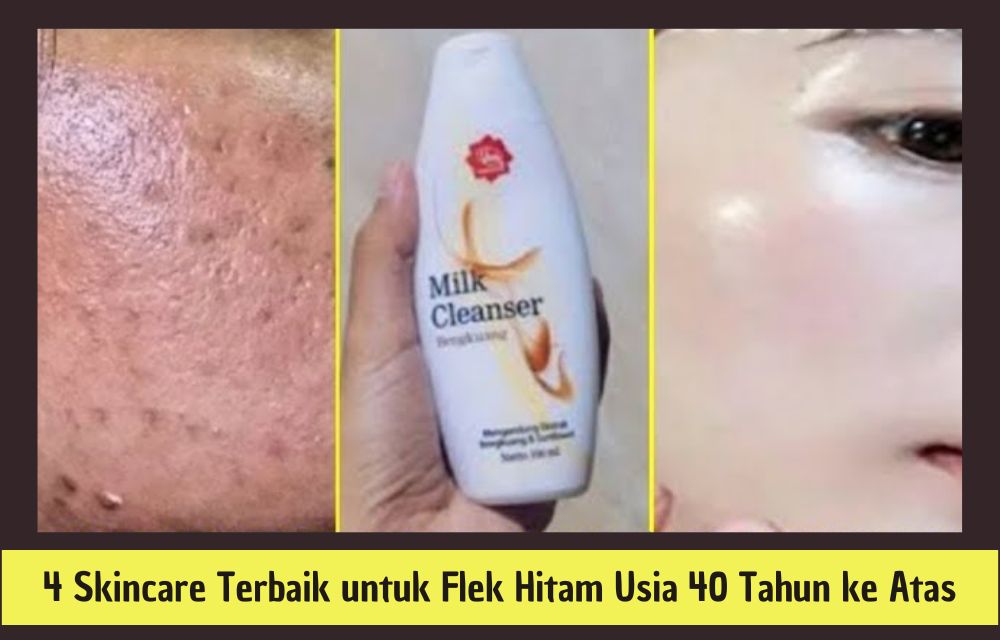 4 Skincare Terbaik untuk Flek Hitam Usia 40 Tahun ke Atas, Minimalkan Tanda Penuaan Bikin Glowing!