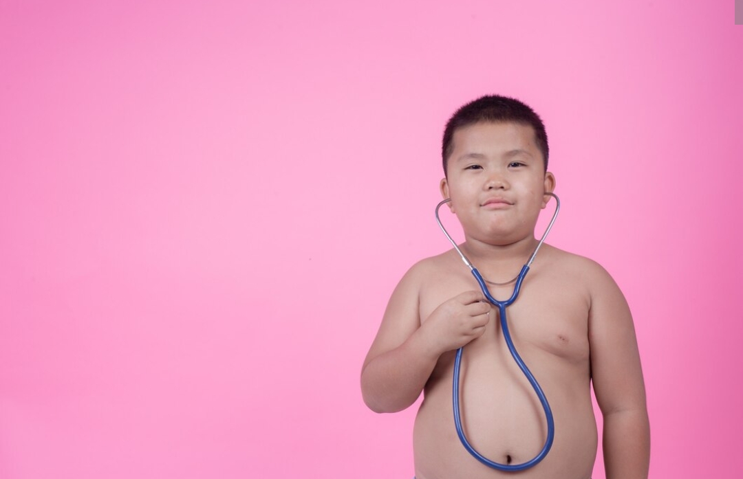 Orang Tua Wajib Tahu, Inilah 5 Makanan Penyebab Obesitas Pada Anak, Lebih Baik Hindari!