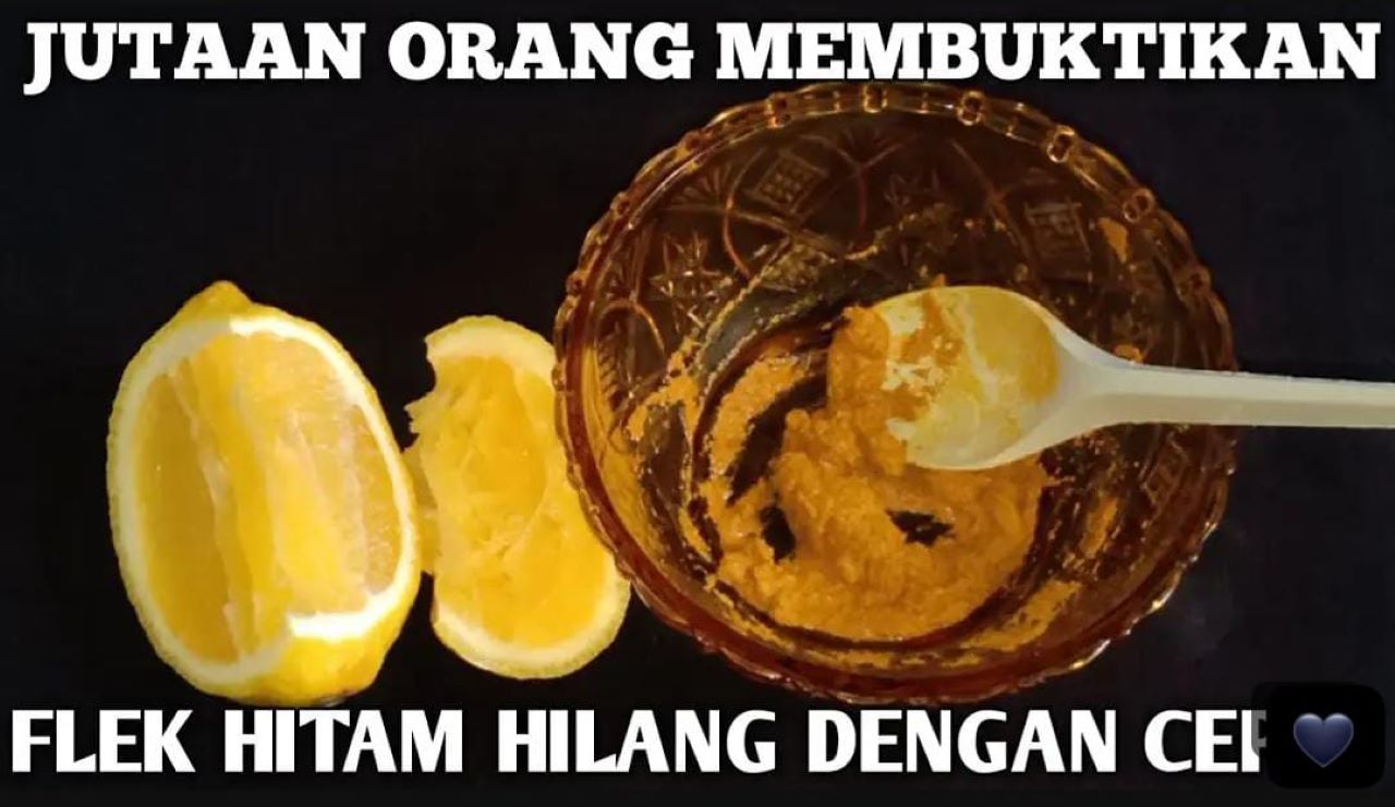 3 Trik Pakai Lemon untuk Kulit Glowing dan Bebas Flek Hitam yang Paling Ampuh