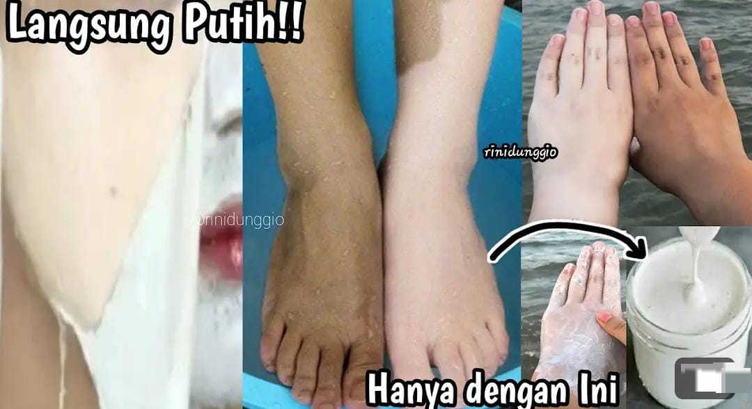 3 Cara Membuat Masker Alami untuk Memutihkan Wajah Dalam 1 Malam Cuma Pakai Bahan Dapur, Wajah Bebas Noda