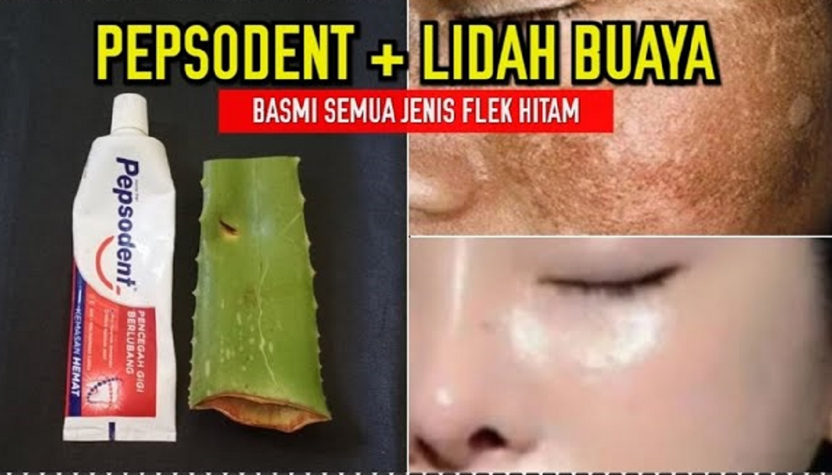 3 Cara Ampuh Menghilangkan Flek Hitam di Wajah dalam Semalam dengan Lidah Buaya, Rahasia Glowing dan Awet Muda