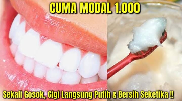 6 Cara Mudah Memutihkan Gigi yang Bisa Dilakukan Sendiri di Rumah, Bebas Plak Selamanya Nggak Perlu Repot