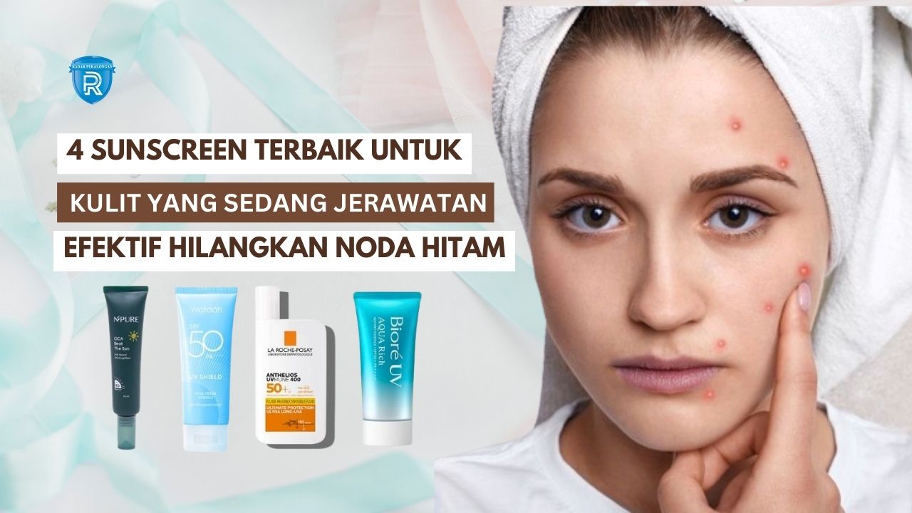 4 Sunscreen Terbaik untuk Kulit yang Sedang Jerawatan, Efektif Hilangkan Noda Hitam Bebas Kilap Seharian