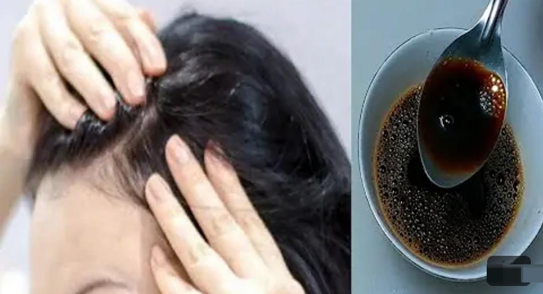 4 Minyak Rambut Anti Uban yang Bikin Rambut Putih jadi Hitam Permanen, Cuma Sekali Oles Rambut Langsung Hitam