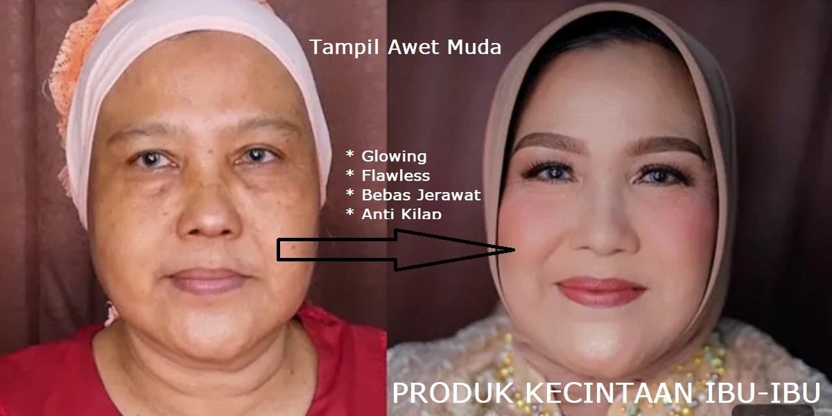 Jaminan Ibu-Ibu Pasti Suka, 3 Bedak untuk Menghilangkan Jerawat dan Memutihkan Wajah, Kulit Glowing Awet Muda