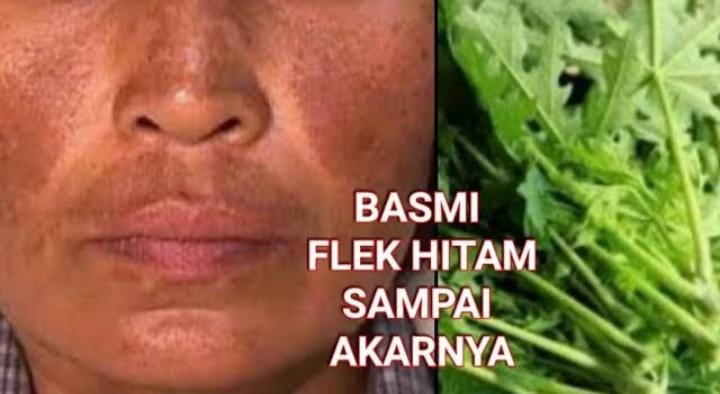 Cara Pudarkan Flek Hitam Tebal dengan Masker Daun Pepaya, Cuma 1 Bahan Bikin Glowing Permanen