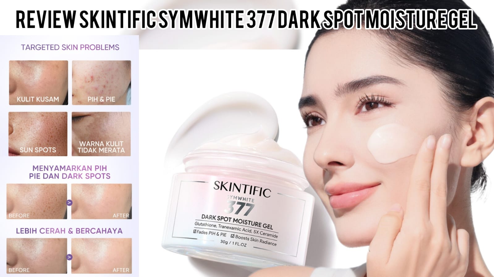 Review Skintific Symwhite377 Moisture Disebut Produk Terbaik Atasi Flek Noda Hitam, Ternyata Ini Rahasianya..