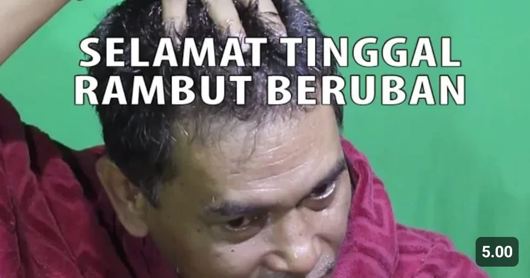 Ini 4 Merk Minyak Kemiri untuk Rambut di Indomaret Terbaik Basmi Uban! Modal 10 Ribuan Rambut Hitam Permanen