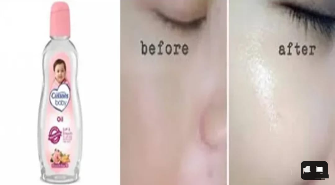 Begini 2 Cara Pakai Baby Oil untuk Memutihkan Wajah Dalam 1 Hari, Bantu Basmi Noda Hitam Secara Permanen