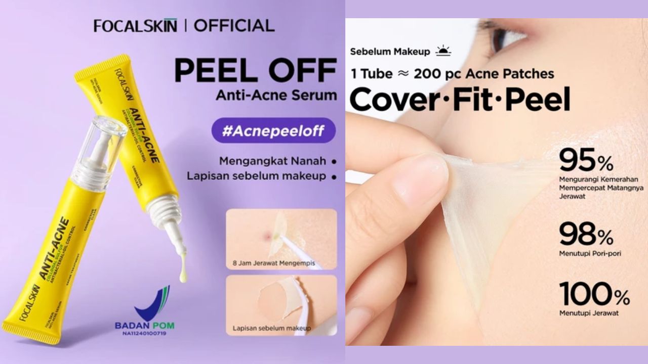 Review Focalskin Anti-Acne Serum Peel Off, 8 Jam Jerawat Langsung Kempis