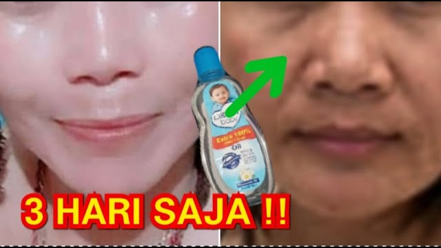 2 Cara Pakai Baby Oil untuk Mengencangkan Kulit Wajah di Usia 50 Tahun, Rahasia Glowing Awet Muda Permanen