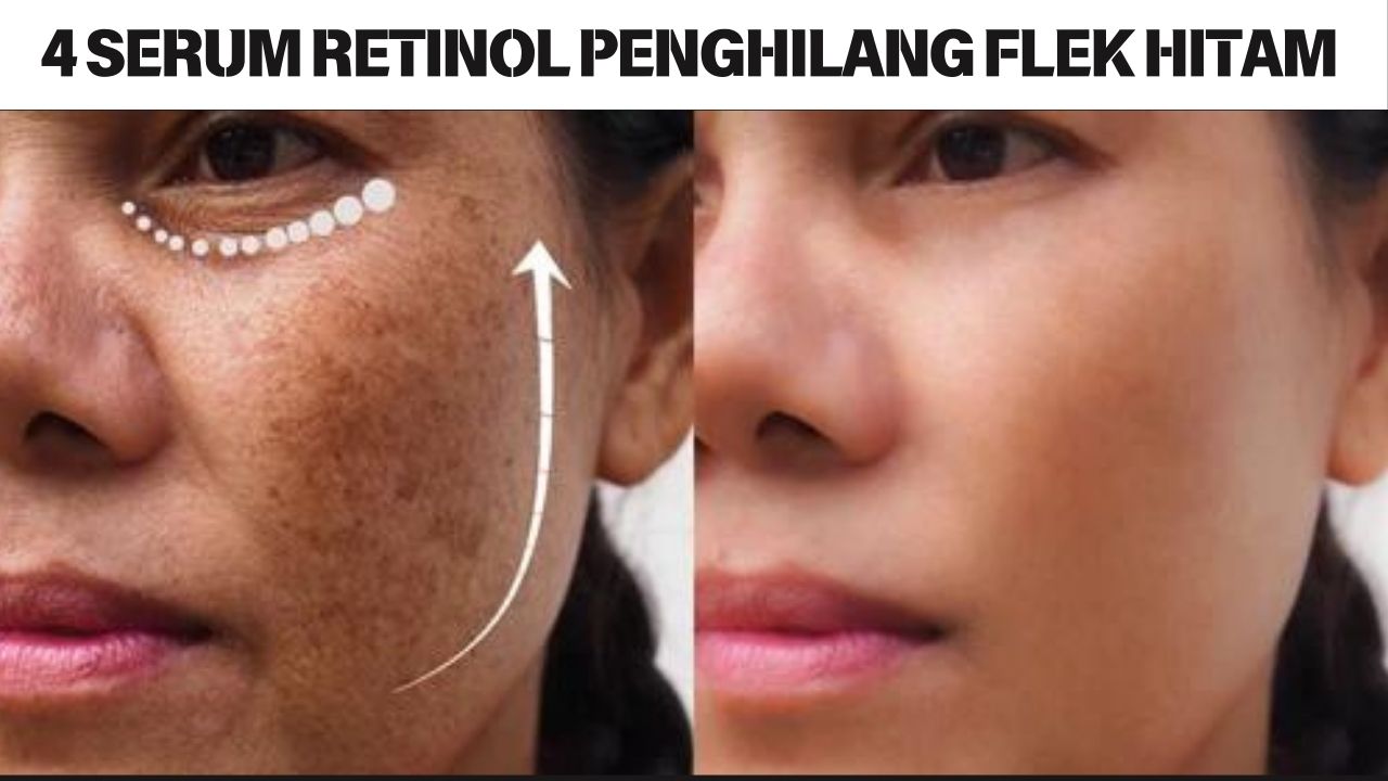 4 Serum Retinol Penghilang Flek Hitam Usia 40 Tahun Ke Atas, Pudarkan Kerutan Bikin Wajah Kencang Awet Muda!