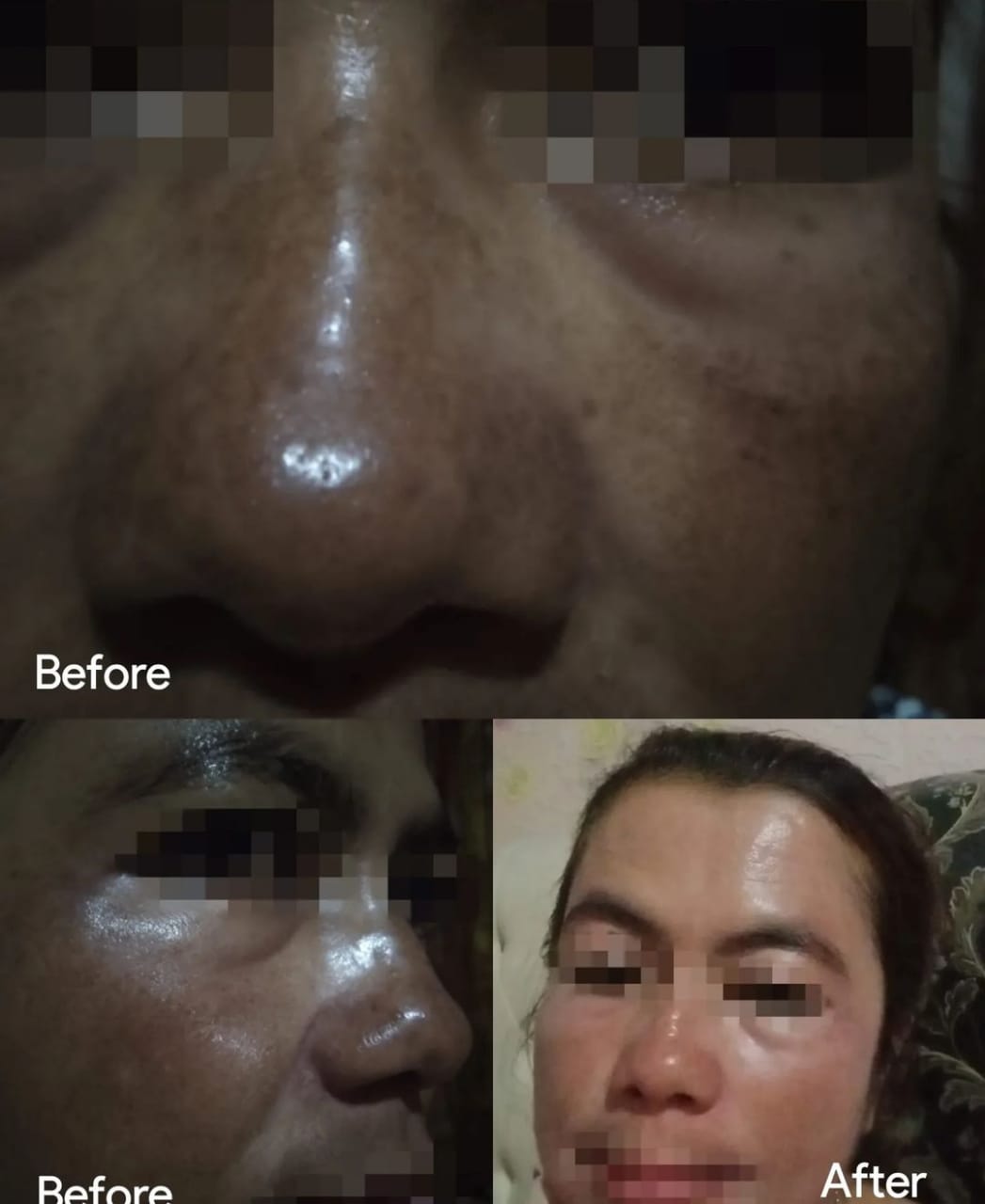 Kamu Harus Tahu! 4 Skincare Wardah Penghilang Flek Hitam Ini Bikin Wajahku Mulus dan Awet Muda