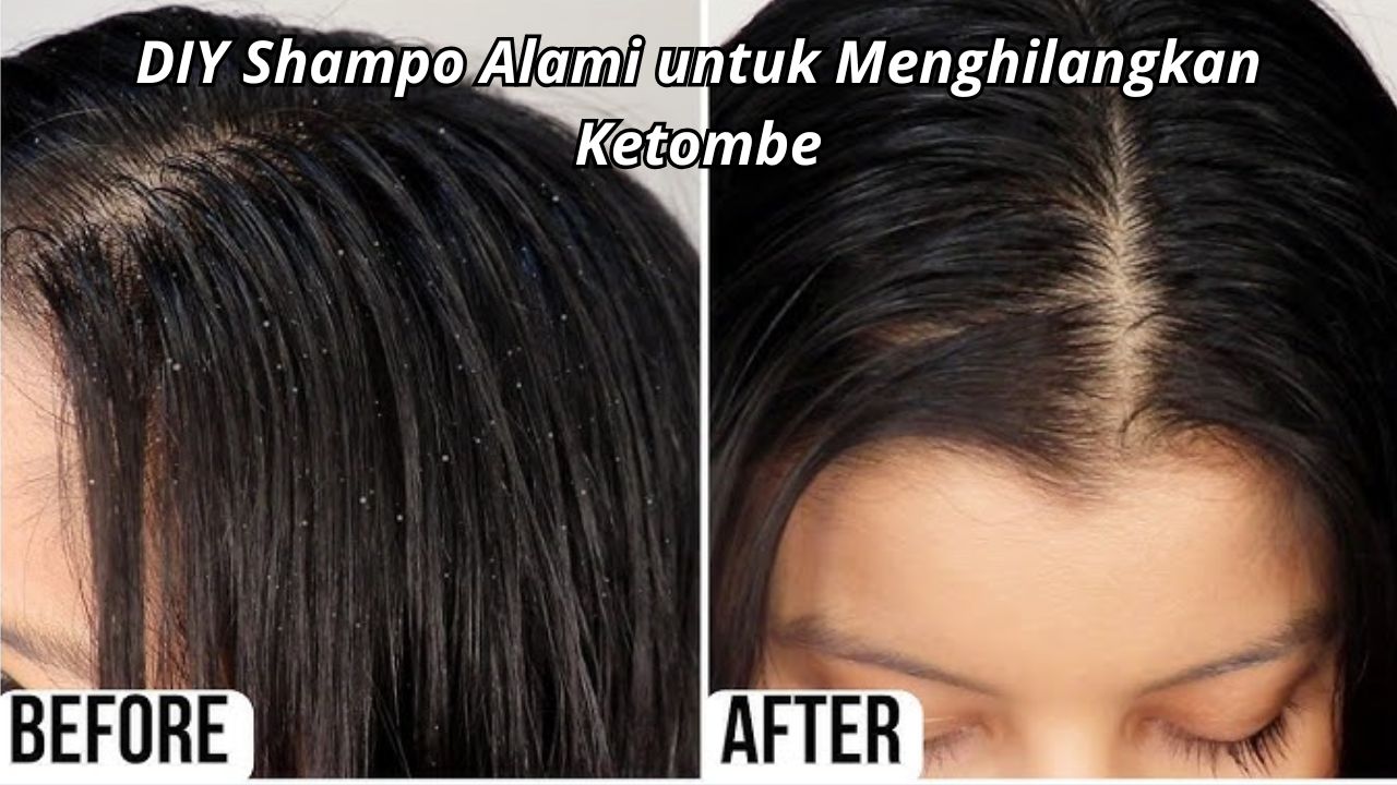 DIY Shampo Alami untuk Menghilangkan Ketombe, Campurkan 2 Bahan Ini 