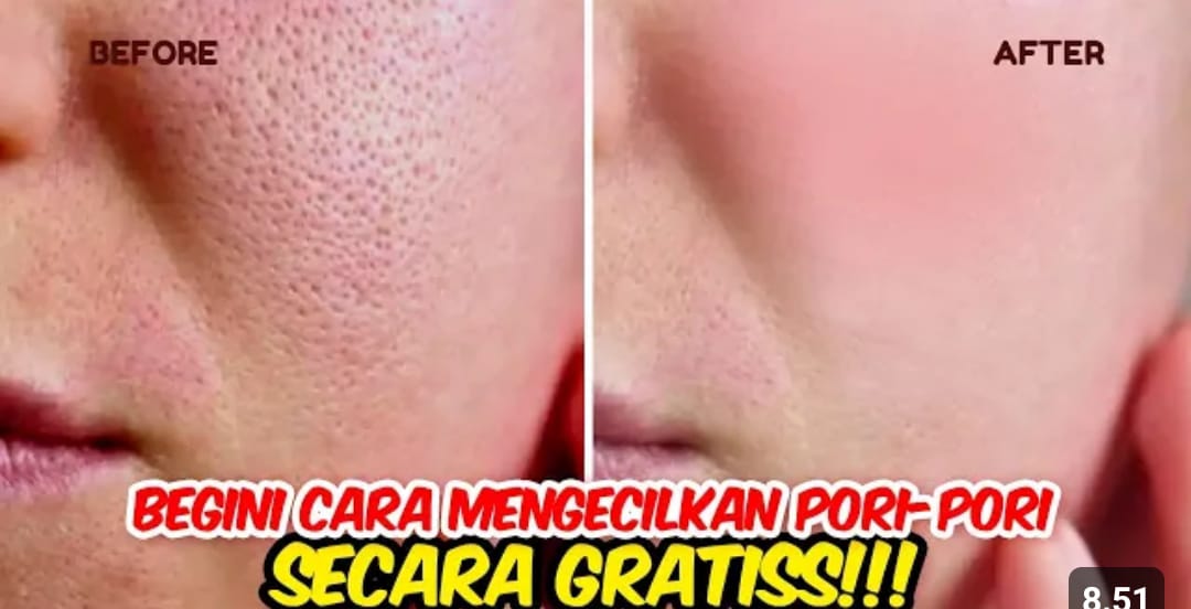 4 Cara Menghilangkan Pori-Pori di Wajah Secara Alami Sebelum Tidur yang Benar! Wajah Jadi Glowing di Pagi Hari