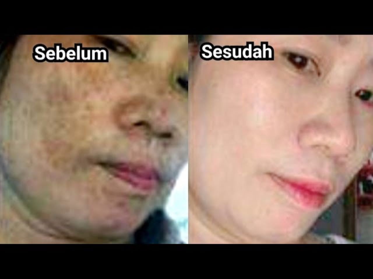 3 Merk Sabun untuk Menghilangkan Flek Hitam yang Wajib Dicoba Jika Ingin Punya Kulit Glowing! Under 50 Ribuan