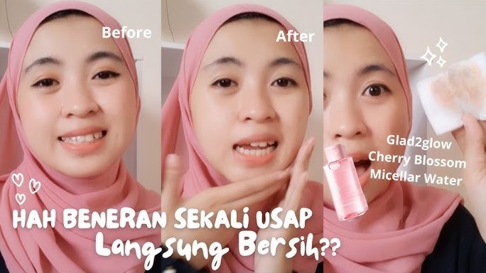 Review Glad2Glow Cherry Blossom Betaine Micellar Water, Bikin Kulit Bersih Tanpa Rasa Lengket