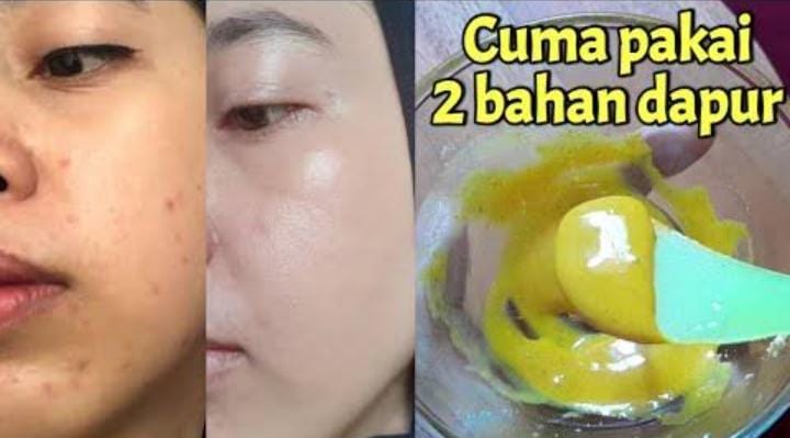 Inilah 4 Bahan Dapur yang Bisa Mencerahkan Wajah Kusam, Lengkap dengan Cara Pakainya yang Paling Benar