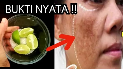 Begini Cara Menghilangkan Flek Hitam Tebal dengan Jeruk Nipis, Cuma 3 Langkah Bikin Glowing Permanen