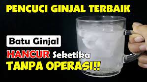 Inilah 5 Minuman Aman Diminum yang Bisa Menghancurkan Batu Ginjal, Rutin Diminum untuk Kesehatan Ginjal