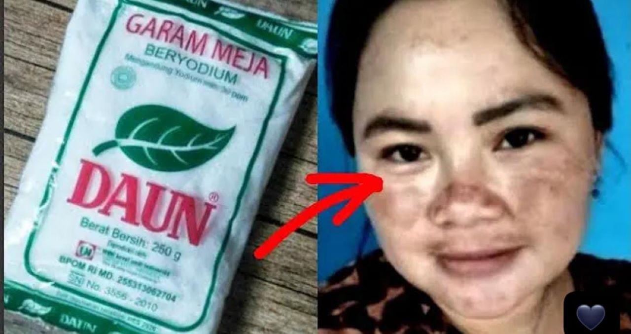 Diy Garam Pengelupas Flek Hitam Dalam 1 Malam, Begini 3 Cara Raciknya Agar Wajah Glowing dan Mulus