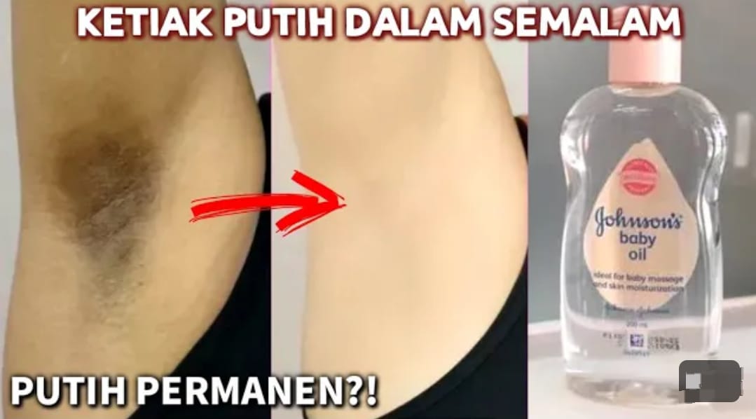 Begini Cara Memutihkan Ketiak dengan Baby Oil Dalam Sekali Usap, Ampuh Bikin Wangi Seharian dan Bebas bau