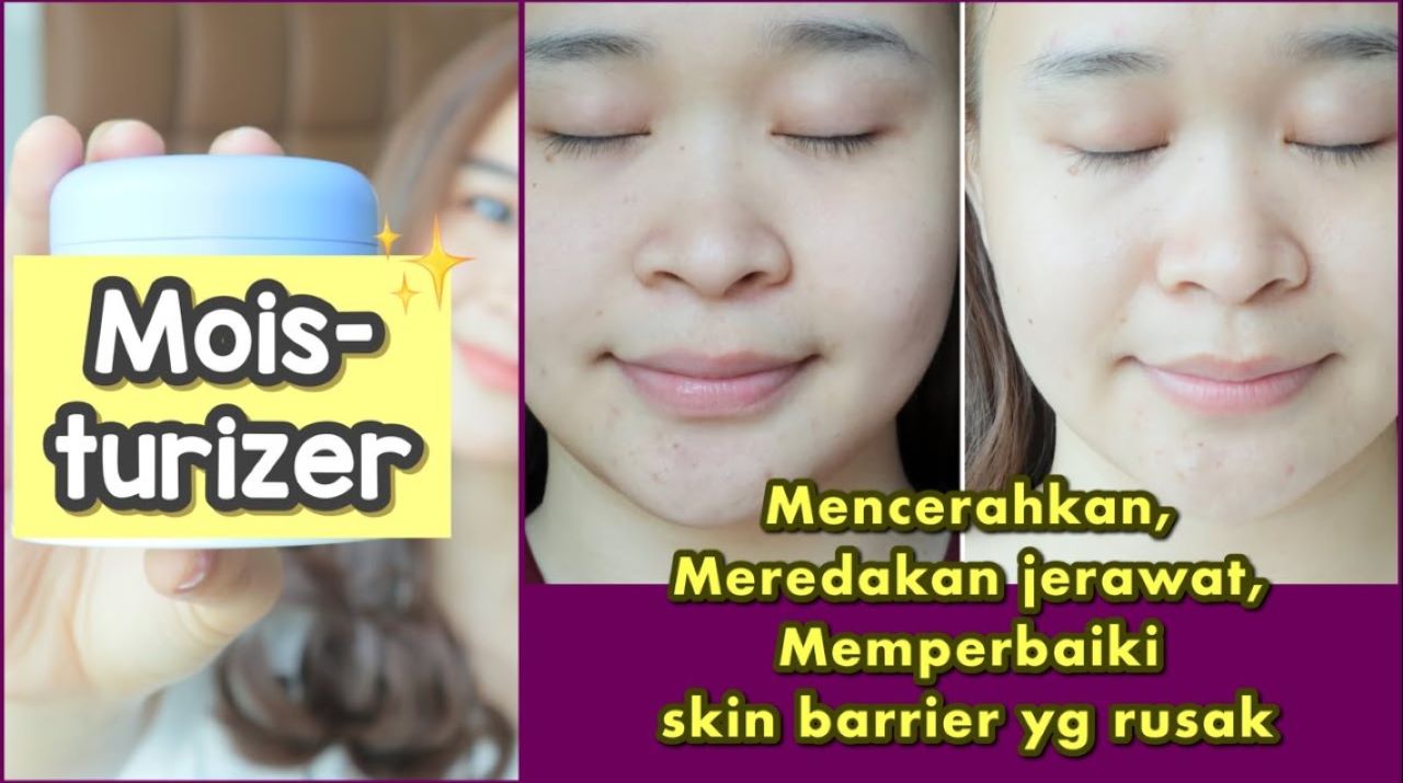 3 Moisturizer untuk Kulit Sensitif, Melembapkan Sekaligus Menenangkan Kulit Kemerahan