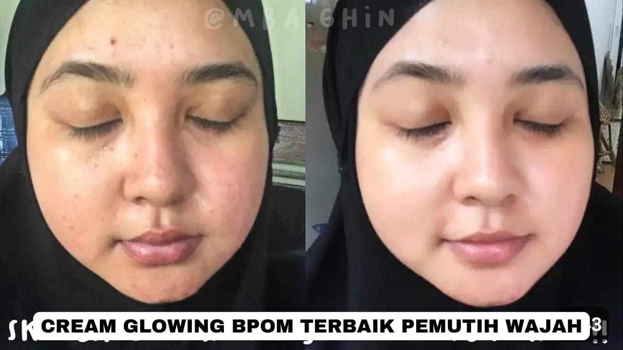 3 Cream Glowing BPOM Untuk Wajah Putih Bebas Noda Hitam, Ampuh Kecilkan Pori-Pori dan Hilangkan Kerutan