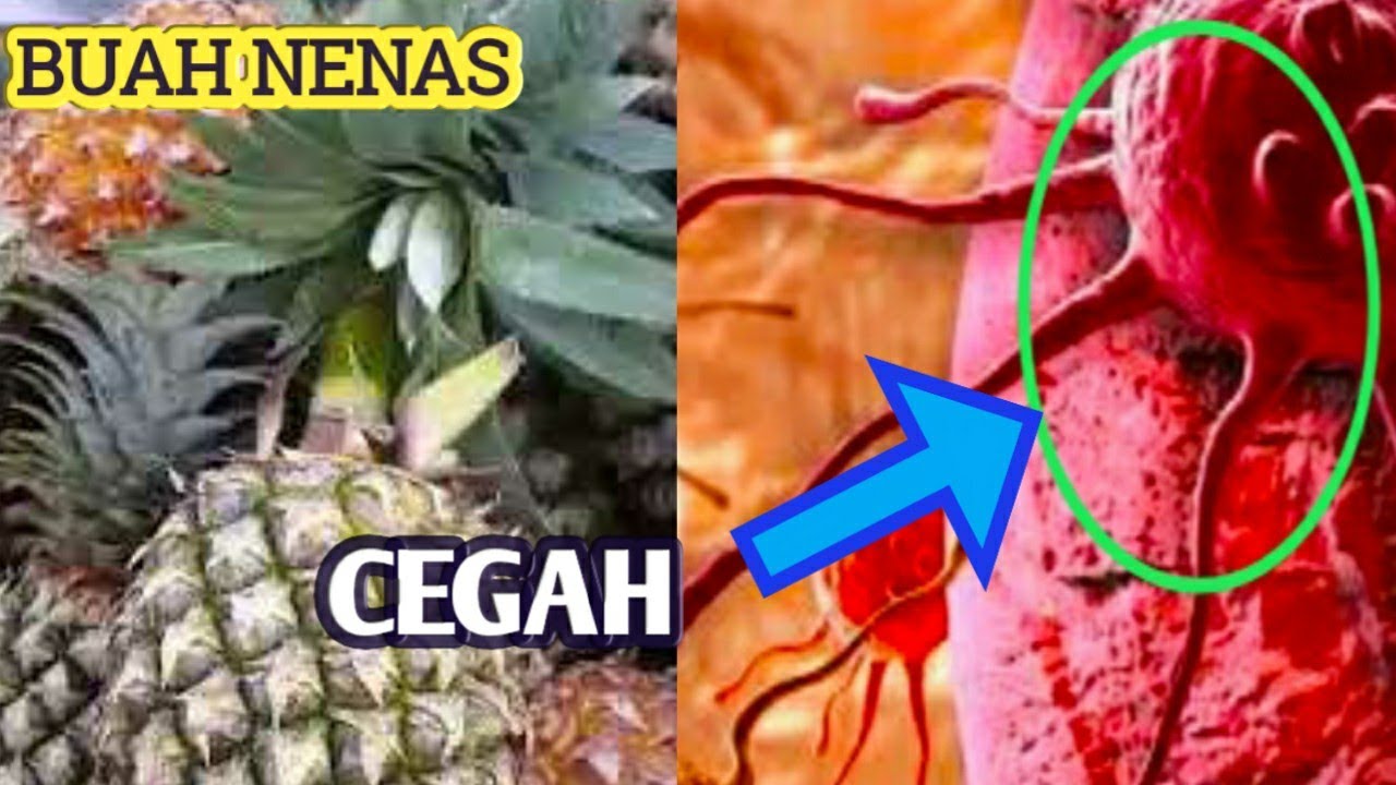 Ini Dia 3 Manfaat Makan Nanas Muda Sebelum Tidur untuk Kesehatan, Mau Tahu Apa Saja?