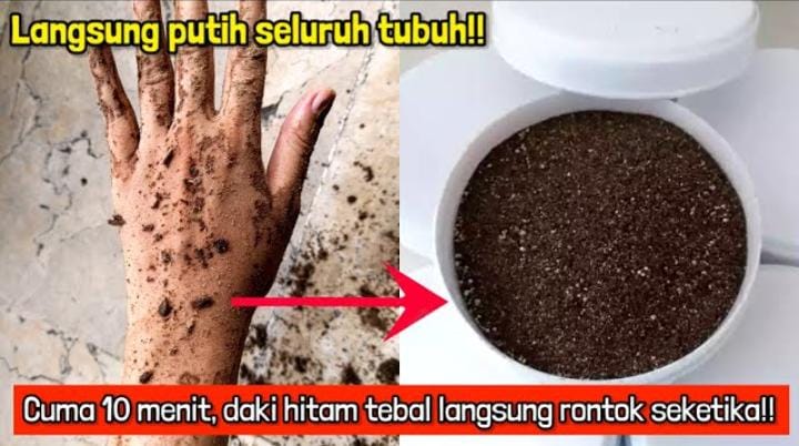 Begini 4 Cara Agar Daki Tidak Menumpuk di Kulit Lagi Secara Permanen, Lakukan Rutin Kulit Bersih Bebas Noda