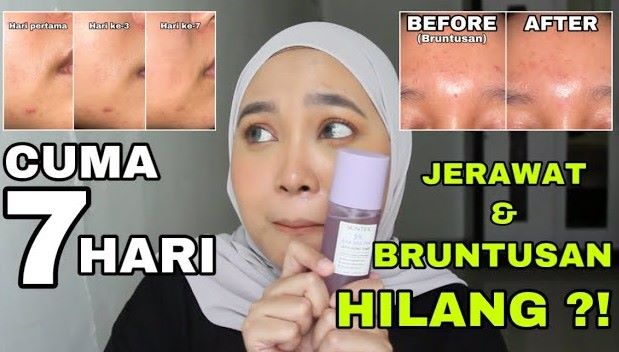 4 Produk Eksfoliasi Terbaik dari Skintific, Ampuh Angkat Sel Kulit Mati dan Kulit jadi Glowing 