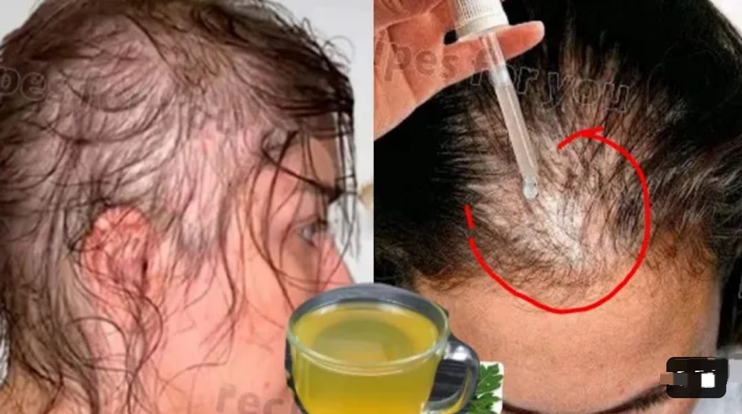 Begini 4 Cara Pakai Olive Oil untuk Rambut yang Benar, Bikin Rambut jadi Sehat dan Hitam Permanen Dengan Cepat