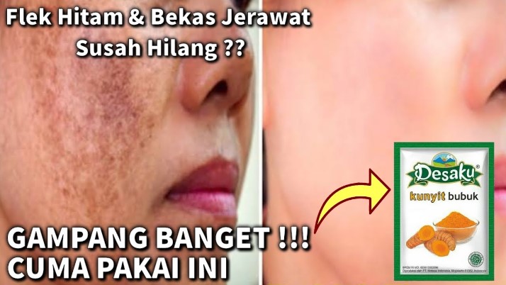 DIY Racikan Kunyit Bubuk untuk Memutihkan Wajah dan Flek Hitam, Rahasia Glowing dalam 4 Langkah