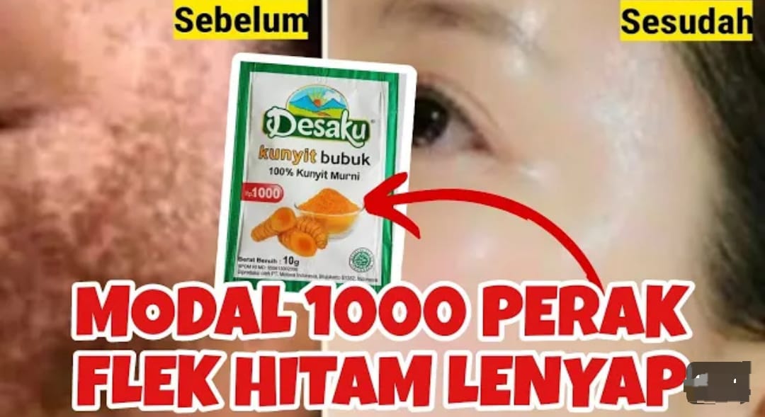 Begini 2 Cara Pakai Desaku Bubuk Kunyit untuk Masker Memutihkan Wajah Dalam Sekali Pakai, Basmi Flek Hitam