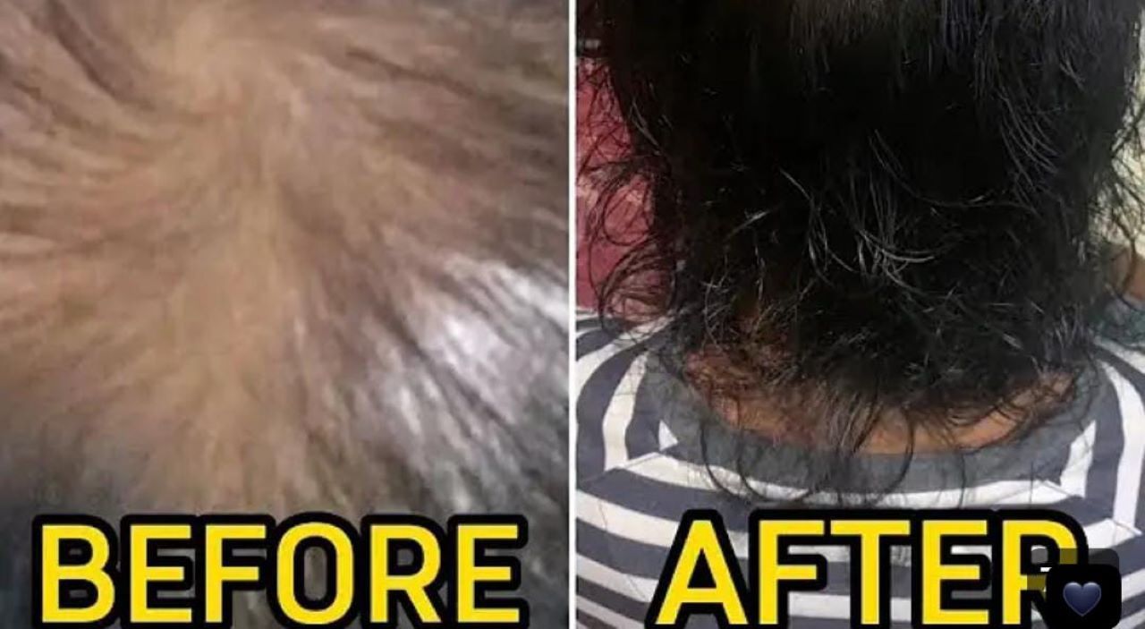 4 Bahan Alami untuk Menghilangkan Rambut Uban Permanen, Ternyata Ini Cara Pakai yang Benar