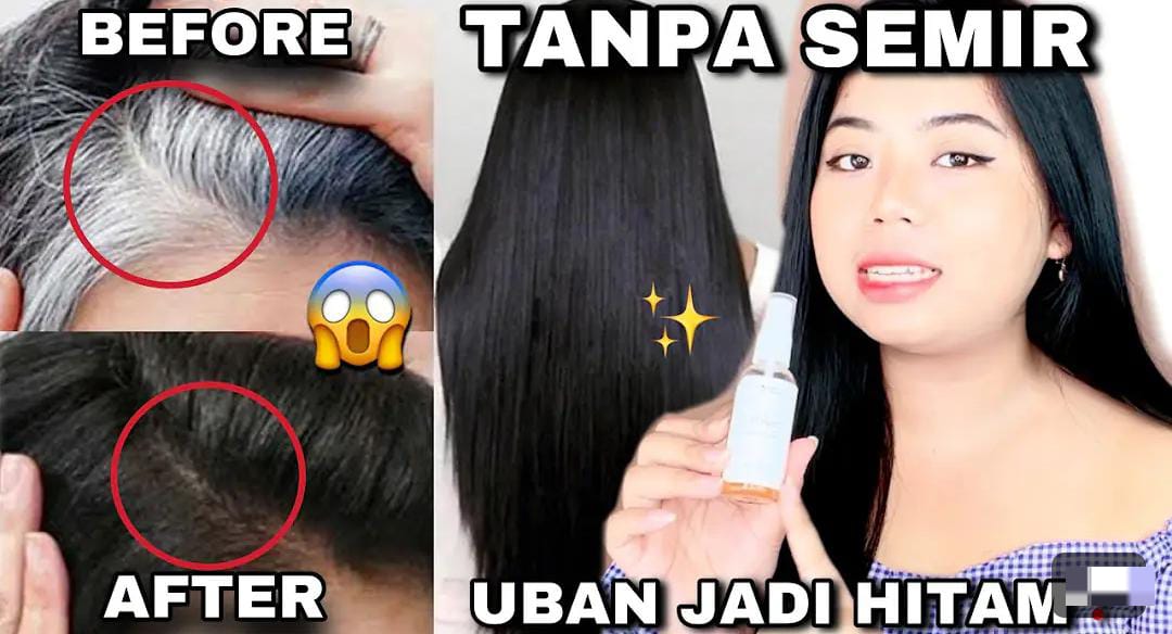 3 Tips Uban Hilang Sampai Ke Akarnya Cukup 5 Menit, Bikin Rambut Putih jadi Hitam Permanen dan Bebas Rontok