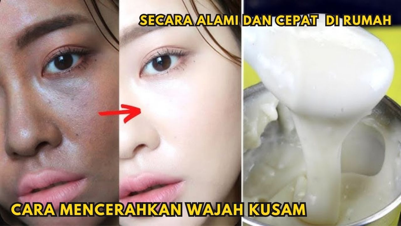 3 Cara Mencerahkan Wajah Kusam Secara Alami dan Cepat, Cobain Sekarang Juga!