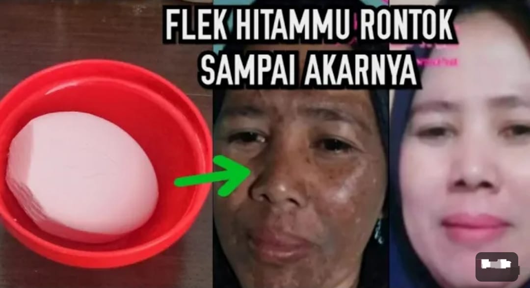 3 Merk Sabun yang Cocok untuk Menghilangkan Noda Hitam di Wajah, Rahasia Pori-Pori Kecil Wajah Putih Glowing