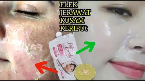 Begini Cara Agar Flek Hitam di Wajah Cepat Mengelupas dalam 1 Malam, Cuma 2 Bahan Bikin Glowing Permanen