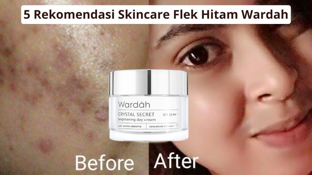 5 Rekomendasi Skincare Flek Hitam Wardah, Bikin Wajah Glowing dan Cerah Merata Rahasia Tampil Awet Muda