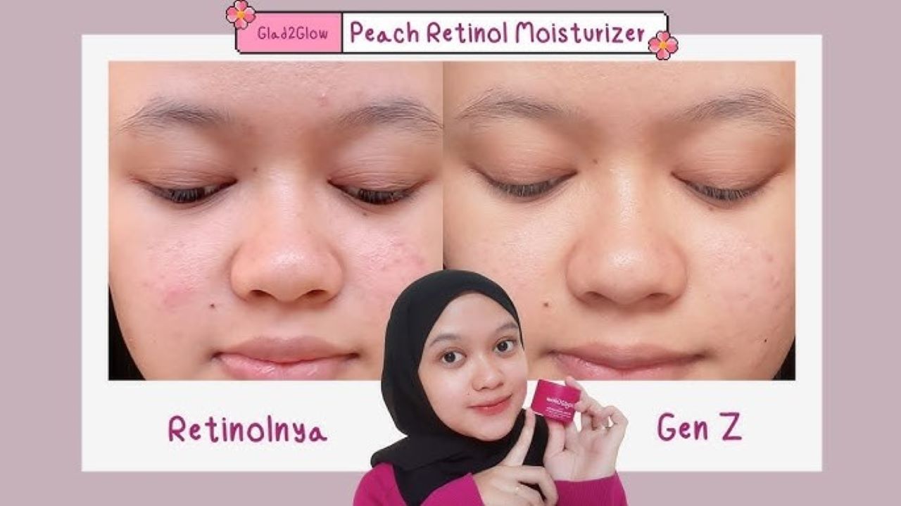 4 Rekomendasi Moisturizer Retinol Agar Kulit Awet Muda, Bantu Atasi Tanda Penuaan