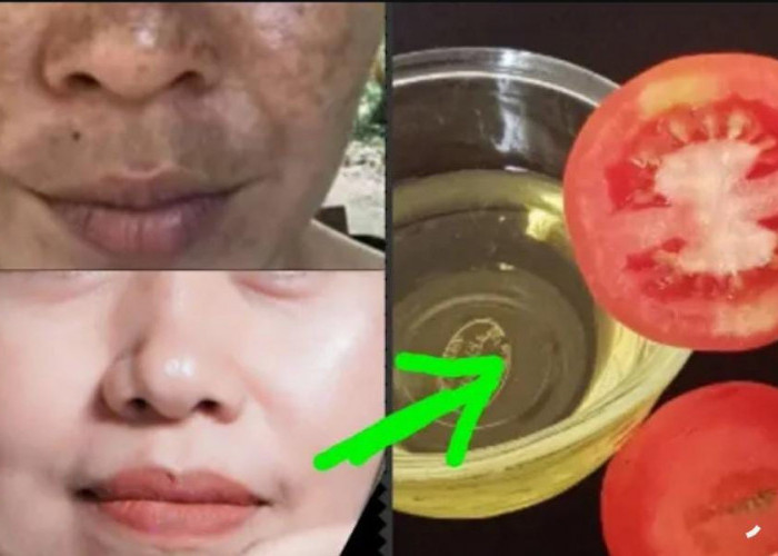 3 Cara Membuat Masker Tomat untuk Wajah Flek Hitam Tebal, Noda Hitam Hilang Kulit jadi Kencang Awet Muda